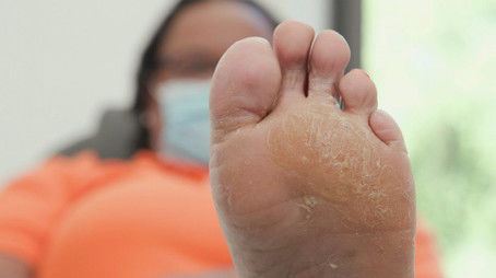 My Foot Looks Like Parmesan Cheese! (2022) - Episode 10 poster and promotional image