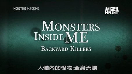 Backyard Killers (2016) - Episode 1 poster and promotional image