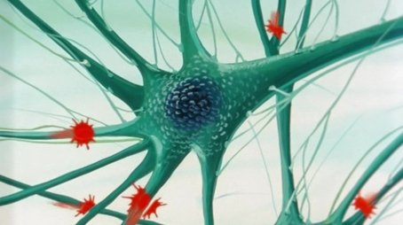 The Neurones (1987) - Episode 10 poster and promotional image