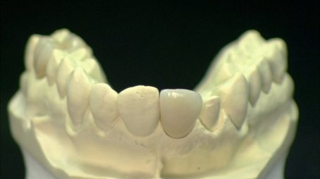 Kelp Caviar, Luxury Sailboats, Dental Crowns, High-Performance Engines (2010) - Episode 1 poster and promotional image