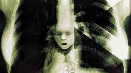 The Kingdom I (1994) - Season 1 poster and promotional image