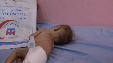 A Living Hell in Yemen/MDMA for PTSD (2018) - Episode 27 poster and promotional image