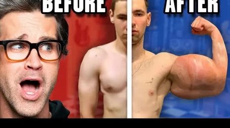 Reacting To Extreme Before And After Photos (2021) - Episode 24 poster and promotional image