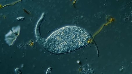 Dileptus: The Toxic Micro Elephant With an Insatiable Appetite (2021) - Episode 10 poster and promotional image