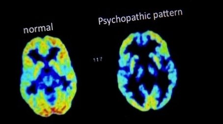 What Makes a Psychopath? (2017) - Episode 12 poster and promotional image