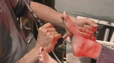 Alternative Medicine (2003) - Episode 2 poster and promotional image