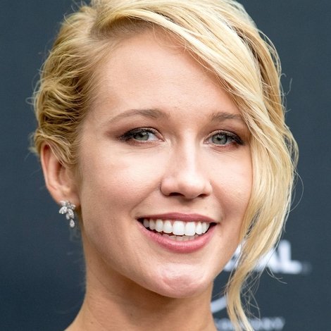 Anna Camp