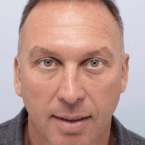 David Platt