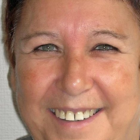 Bernadette Damman