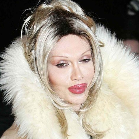Pete Burns