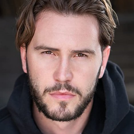 Chase Anderson