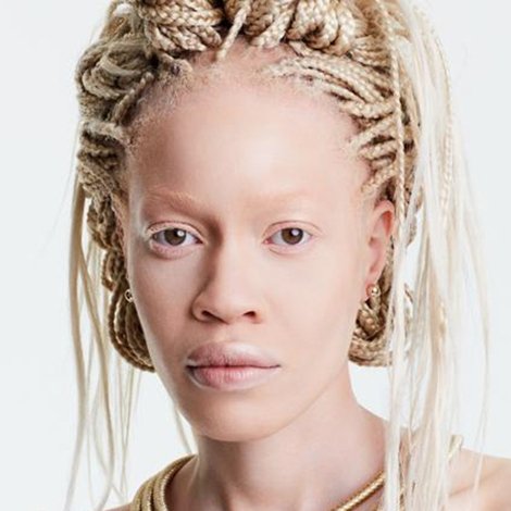 Diandra Forrest