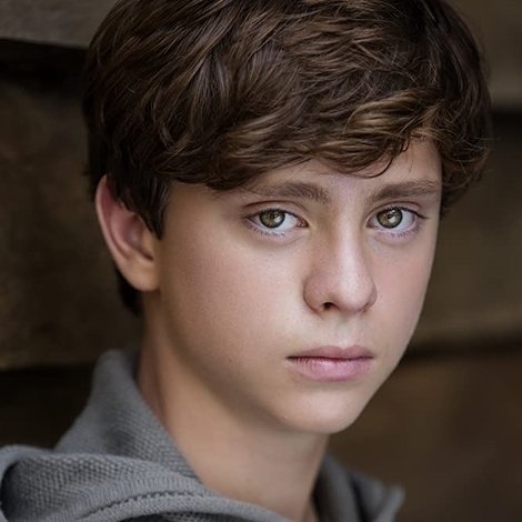 Fraser Anderson