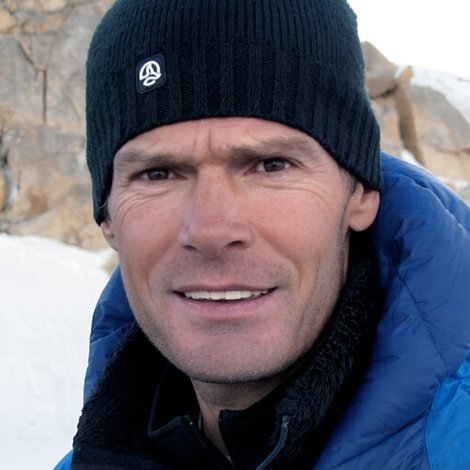 Alberto Iñurrategi