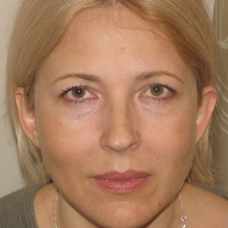 Natalia Pinchuk