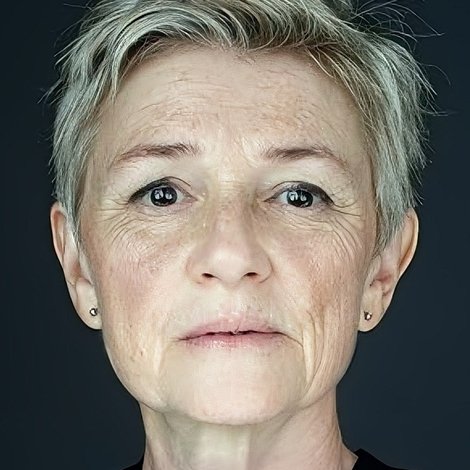 Lawrene Denkers