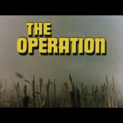 The Operation