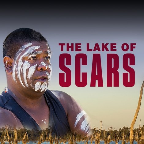 The Lake of Scars