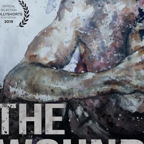 The Wound