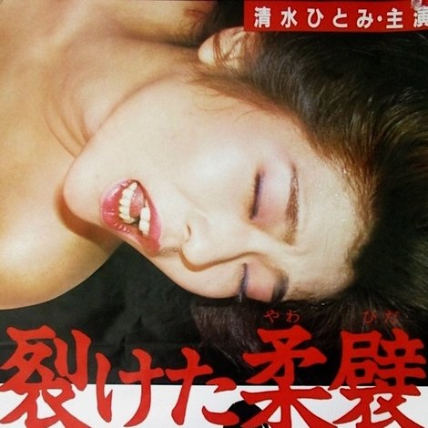 裂けた柔襞