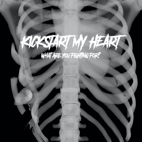 Kickstart My Heart