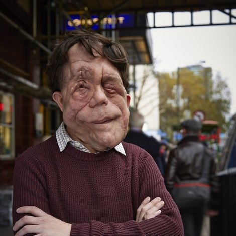 The Ugly Face of Disability Hate Crime