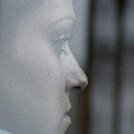 Echo
