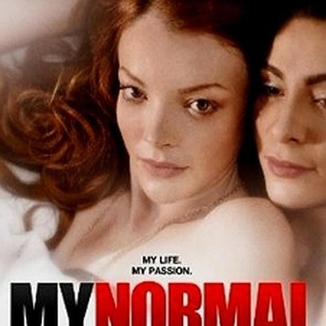My Normal