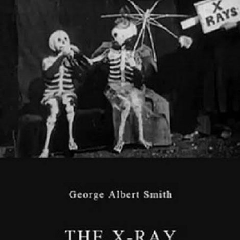 The X-Ray Fiend