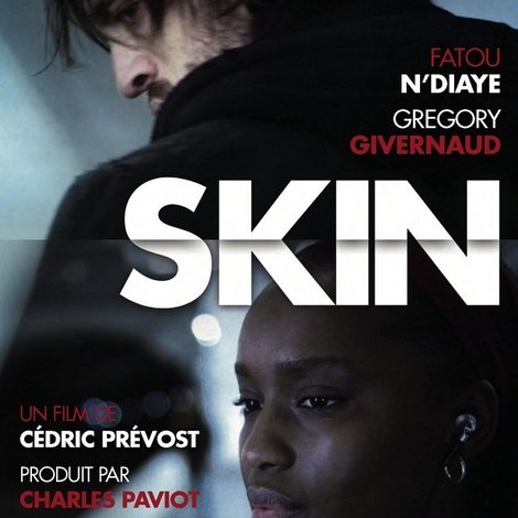 Skin