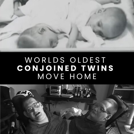 World's Oldest Conjoined Twins Move Home