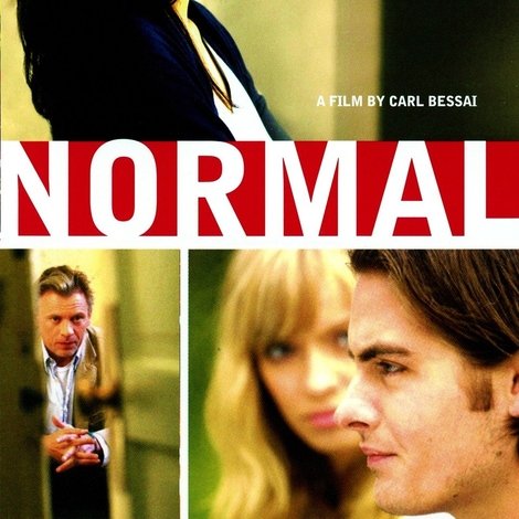 Normal