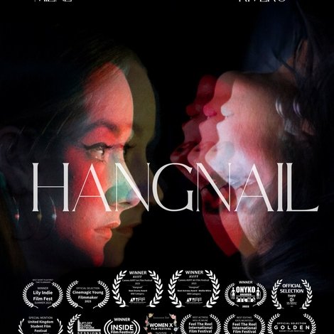HANGNAIL