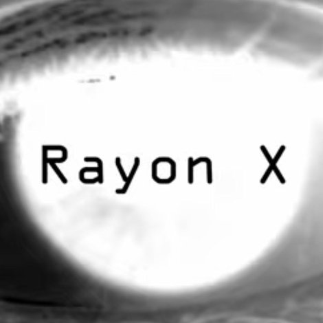 Rayon X