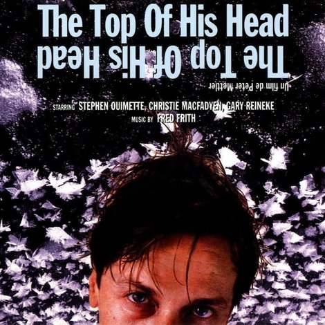 The Top of His Head