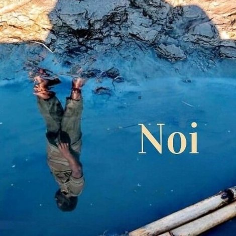 Noi