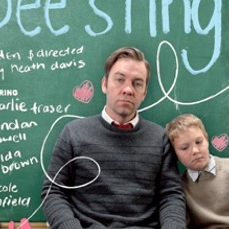 Bee Sting