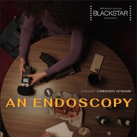An Endoscopy