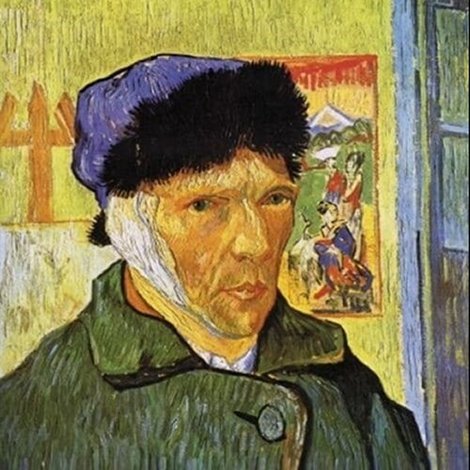 The Mystery of Van Gogh's Ear