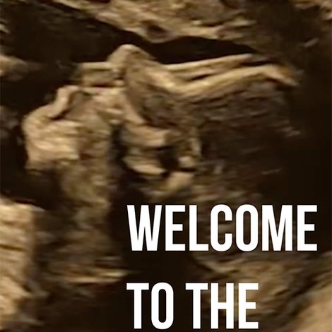 Welcome to the Family