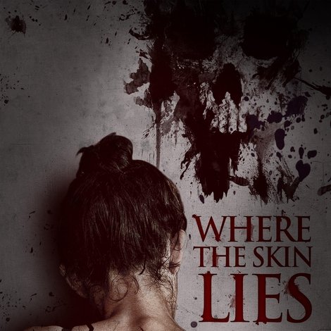 Where the Skin Lies