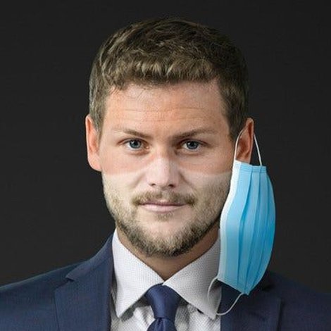 Drew Lynch: Concussed