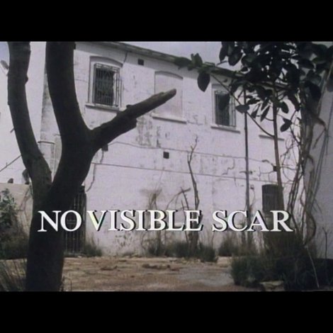 No Visible Scar