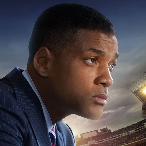 Concussion