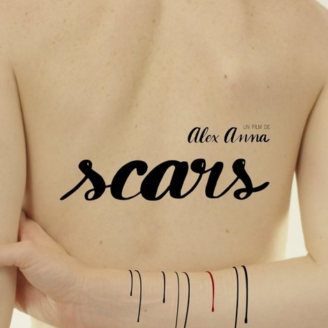 Scars