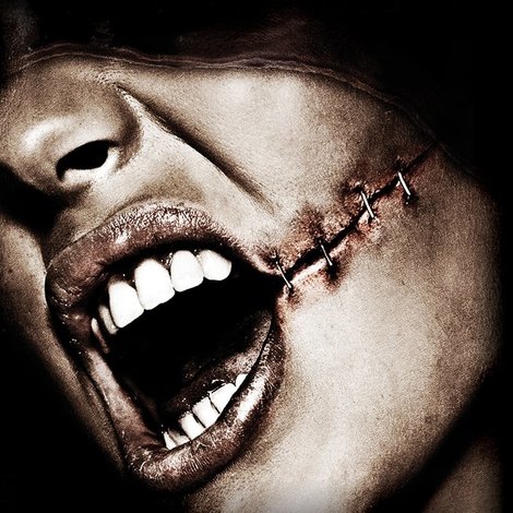 Scar