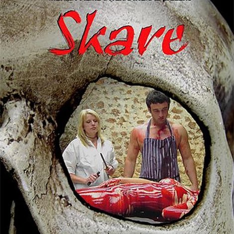 Skare
