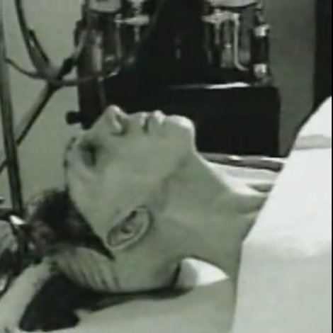 Autopsy