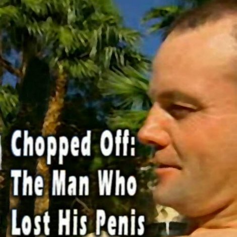 Chopped Off: The Man Who Lost His Penis