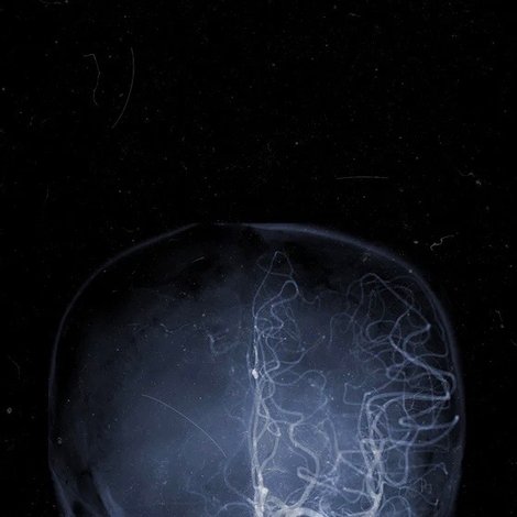 Rethinking Death